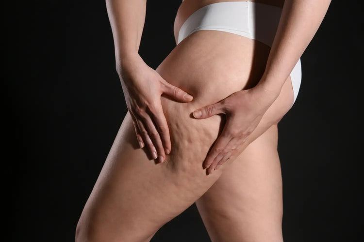 Dry Brushing for Cellulite: Combining Gua Sha for Best Results