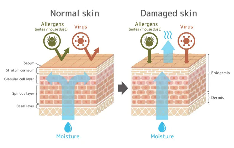 Recognizing the Signs of a Damaged Skin Barrier