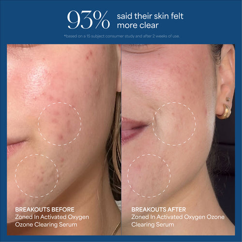 Zoned In Activated Oxygen Ozone Clearing Serum