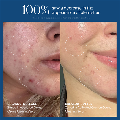 Zoned In Activated Oxygen Ozone Clearing Serum